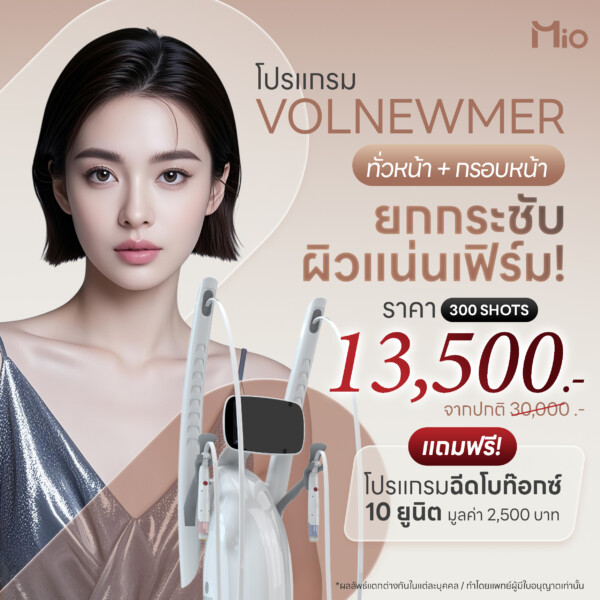 u3 Volnewmer ยกกระชับ แก้ม Mio clinic
