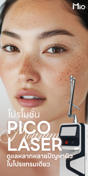 u3 mio pico laser promotion