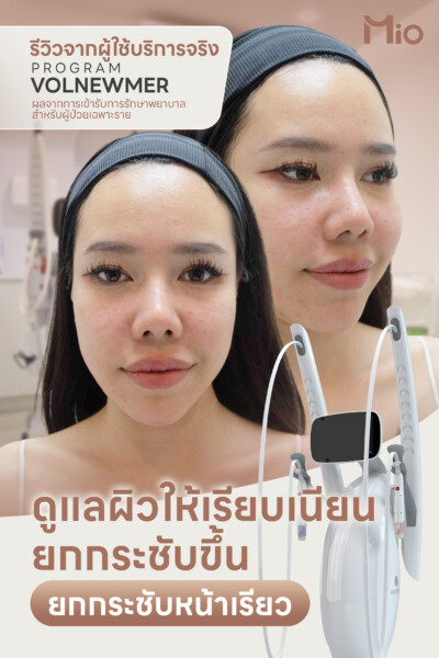 u3 st 5 15 mio clinic 1.3 1