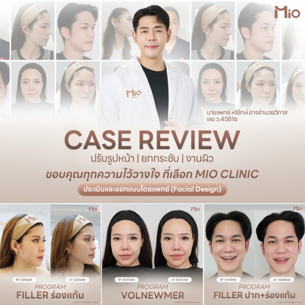 u3 รวมรีวิว กย