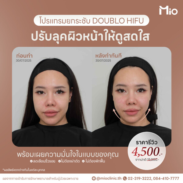 u3 ออกแบบภาพกราฟิก 16 20 Mio Clinic