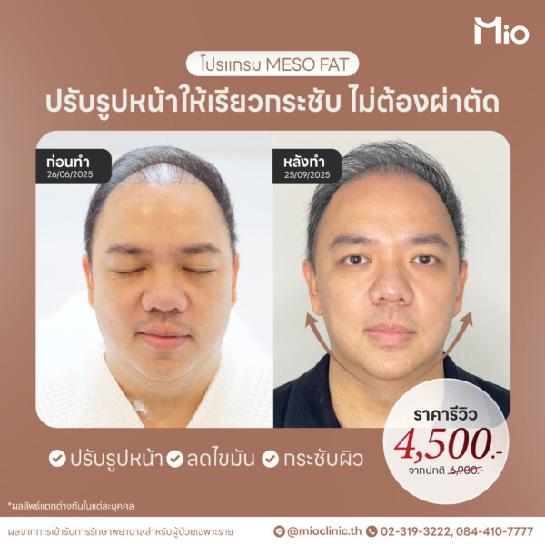 u3 ออกแบบภาพกราฟิก 18 20 Mio Clinic