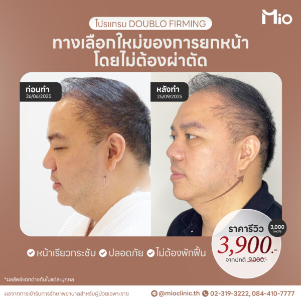 u3 ออกแบบภาพกราฟิก 20 20 Mio Clinic