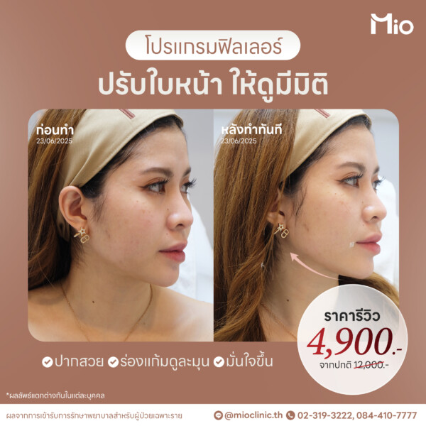 u3 ออกแบบภาพกราฟิก 9 20 Mio Clinic