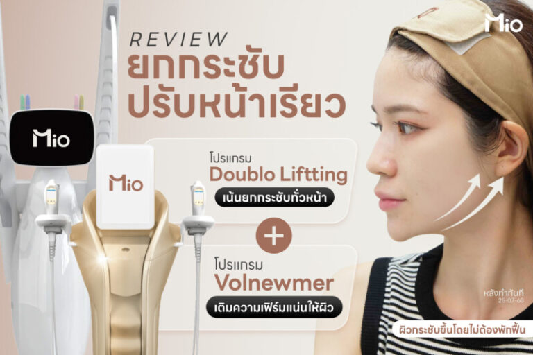 review doublo lifting volnewmer mio clinic before after