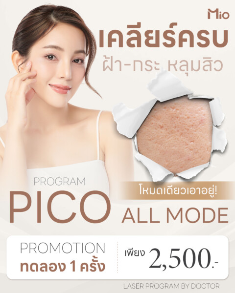 pico all mode mio clinic.jpg