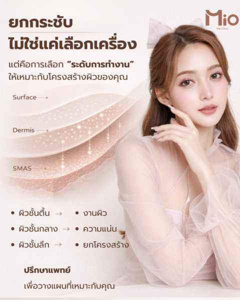 lifting-skin-layer-mio-clinic-2