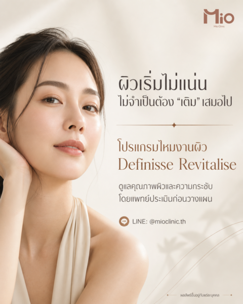 Mio-Definisse-Revitalise