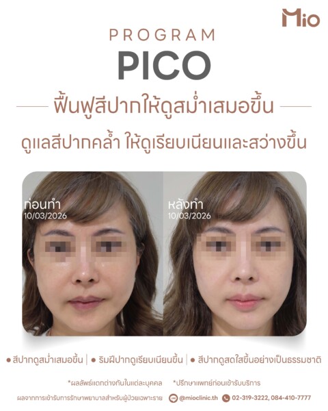 review program pico dark lips mio clinic before after