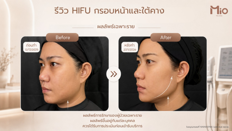 Mio Hifu Doublo Web 8