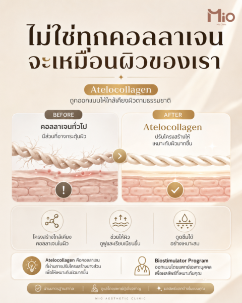 Mio-Therafill-ไม่ใช่ทุกคอลลาเจน