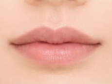 Mio Website Filler Lips 5 แก้ไขแล้ว 1