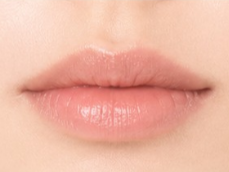 Mio Website Filler Lips 5 แก้ไขแล้ว 2