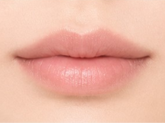 Mio Website Filler Lips 5 แก้ไขแล้ว 4