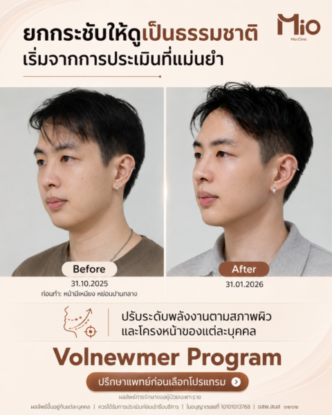 Volnewmer IG