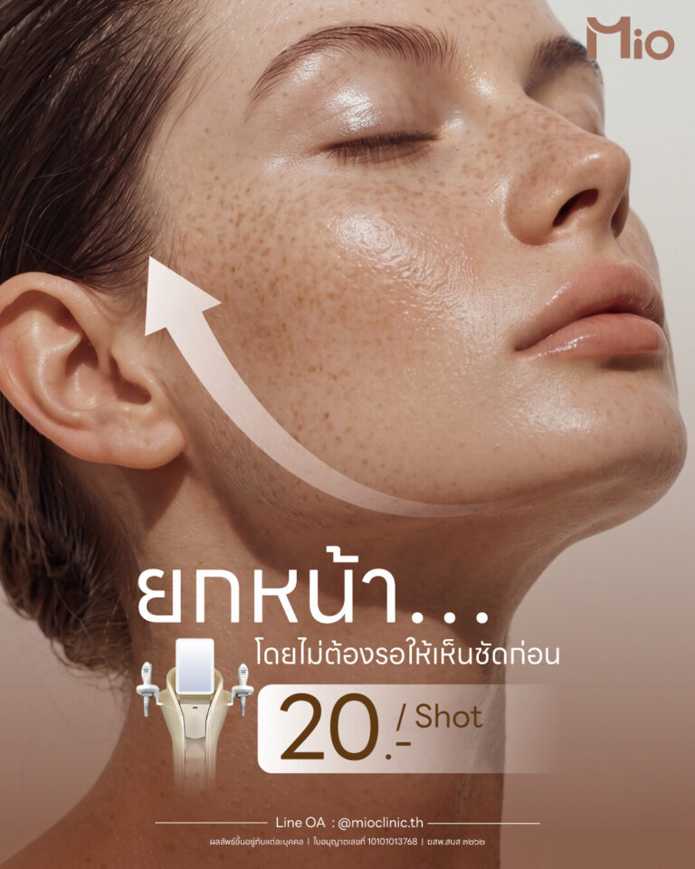 mio clinic doublo 20 baht per shot promotion 2026