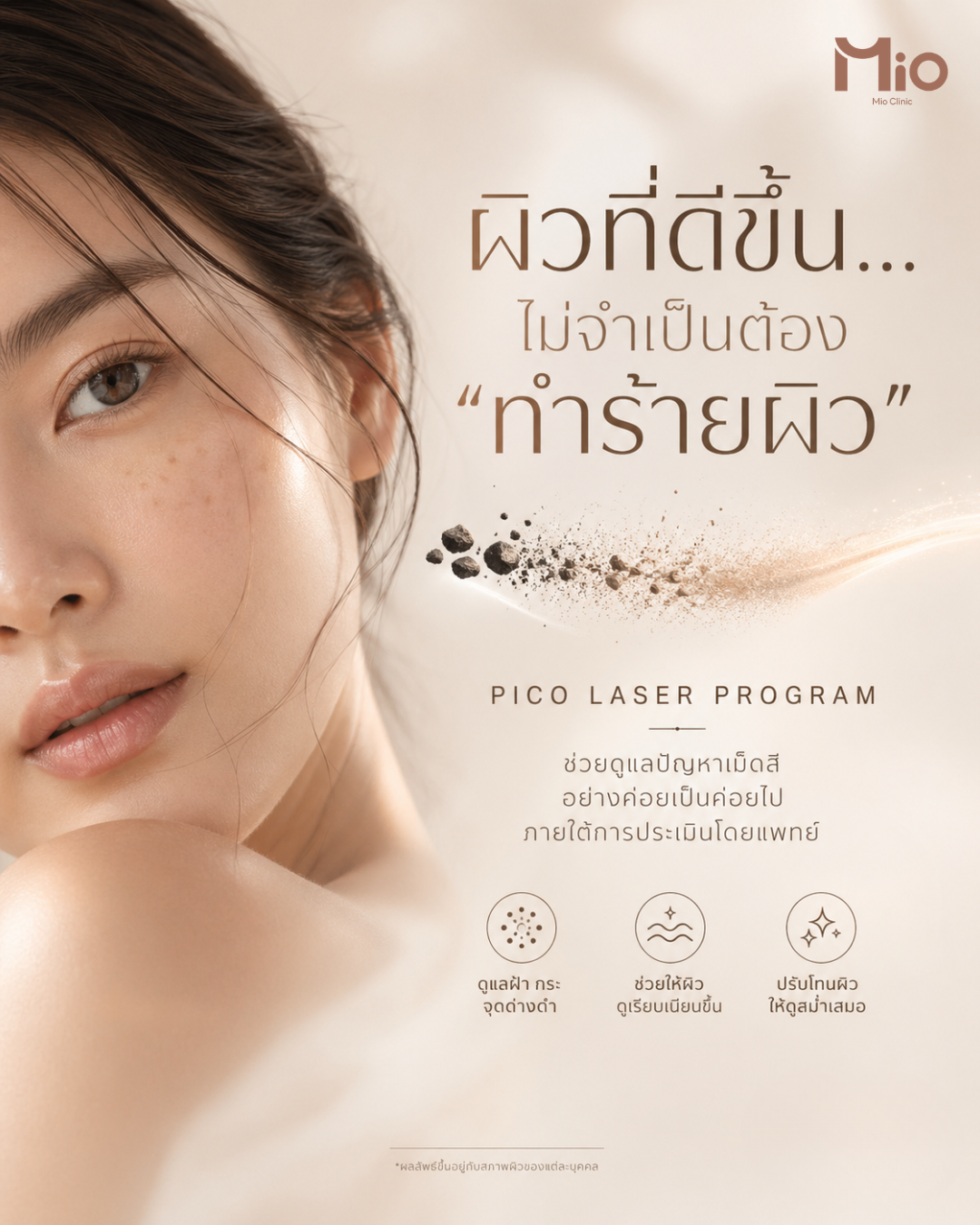 pico-laser-clearer-skin-mio-clinic