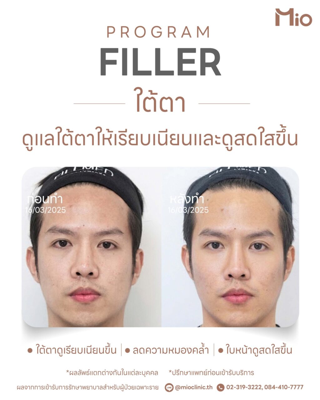 program filler under eye smoother look 03 1