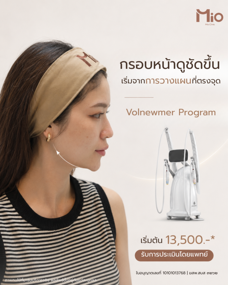 volnewmer program face contour price 16500 mio clinic