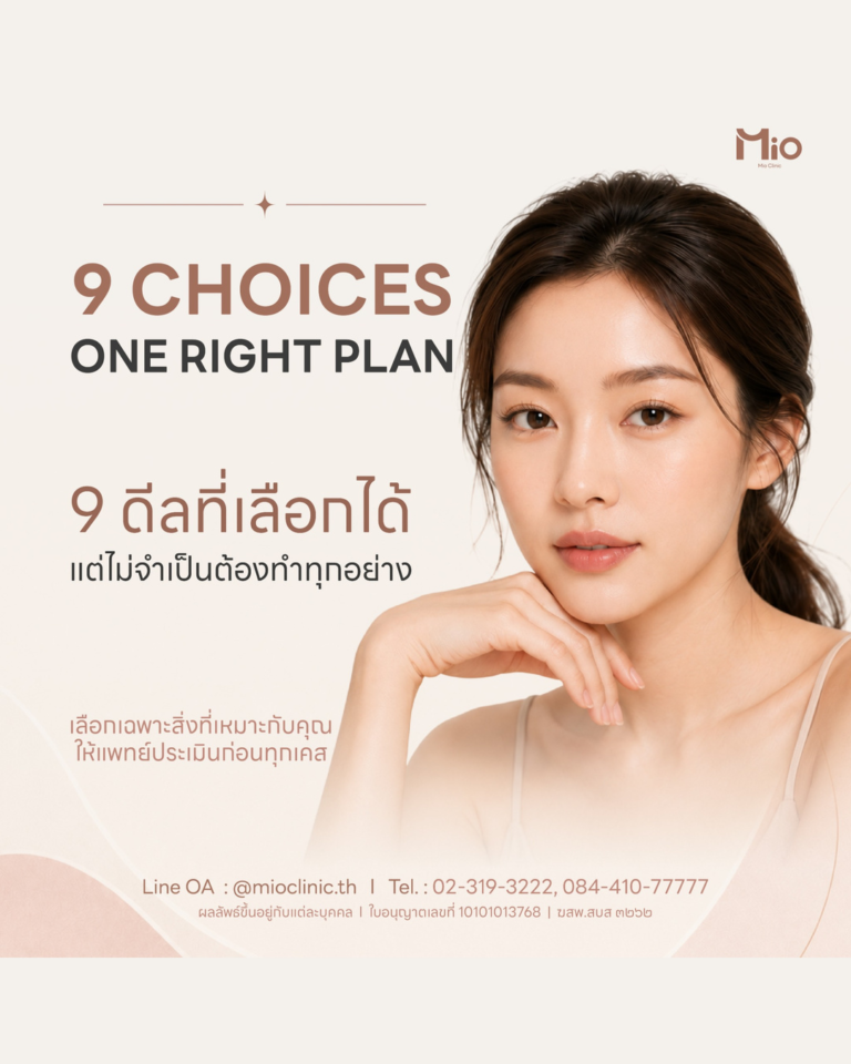 Promotion Mio IG 3