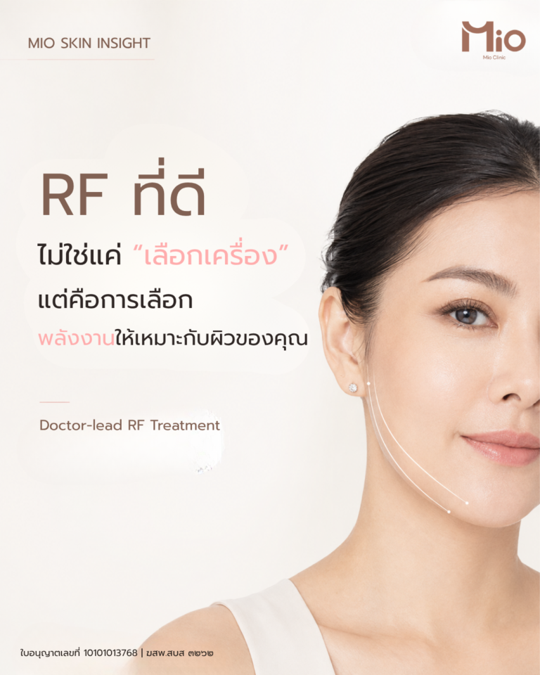 doctor led volnewmer rf treatment mio clinic