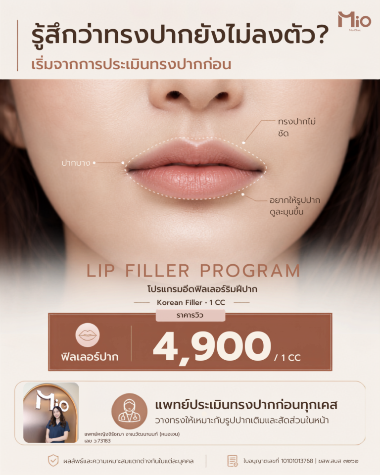 lip filler program korean filler 4900 mio clinic