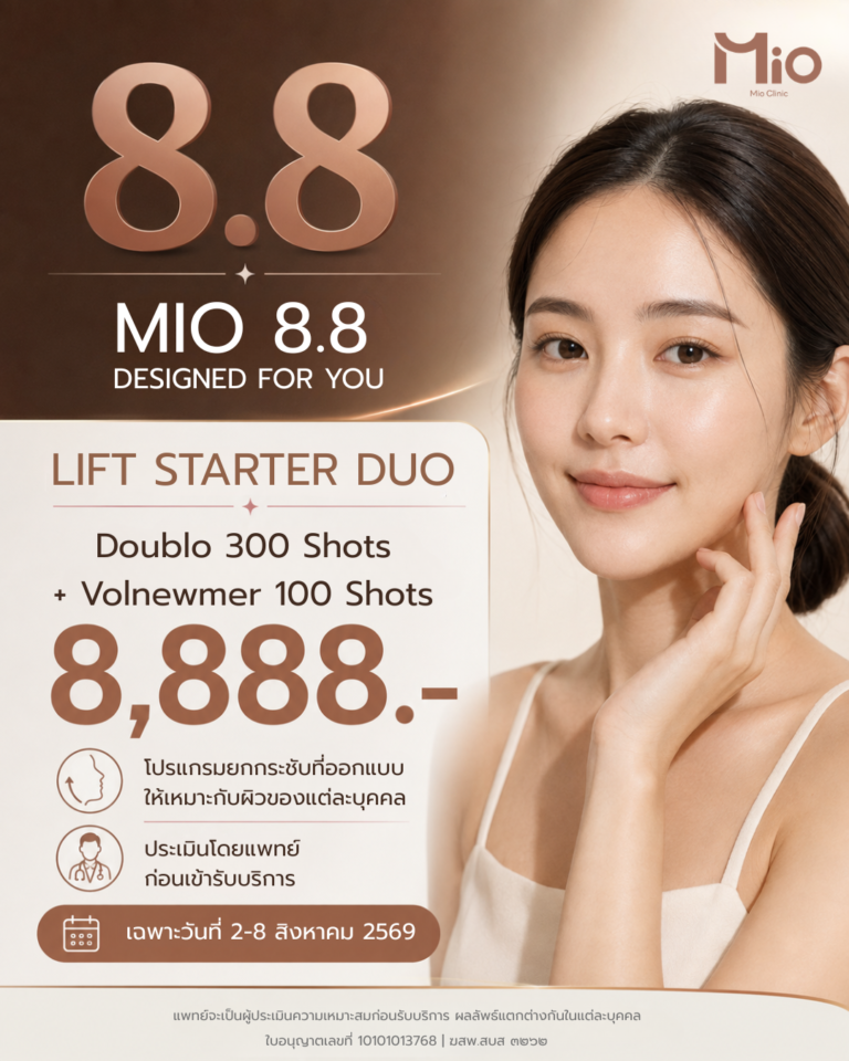mio 88 lift starter duo doublo volnewmer 2026