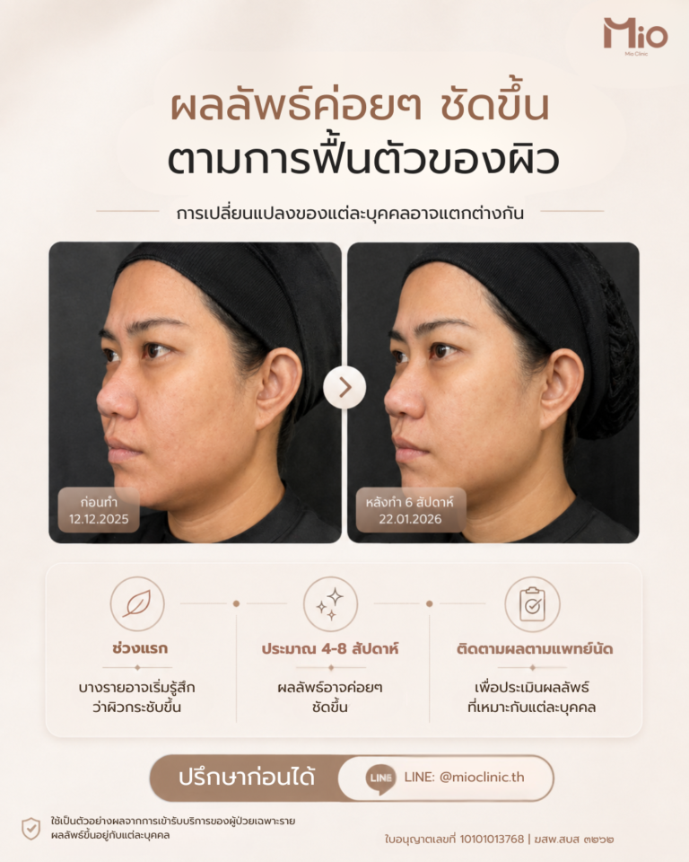 mio clinic doublo program review 6 weeks before after