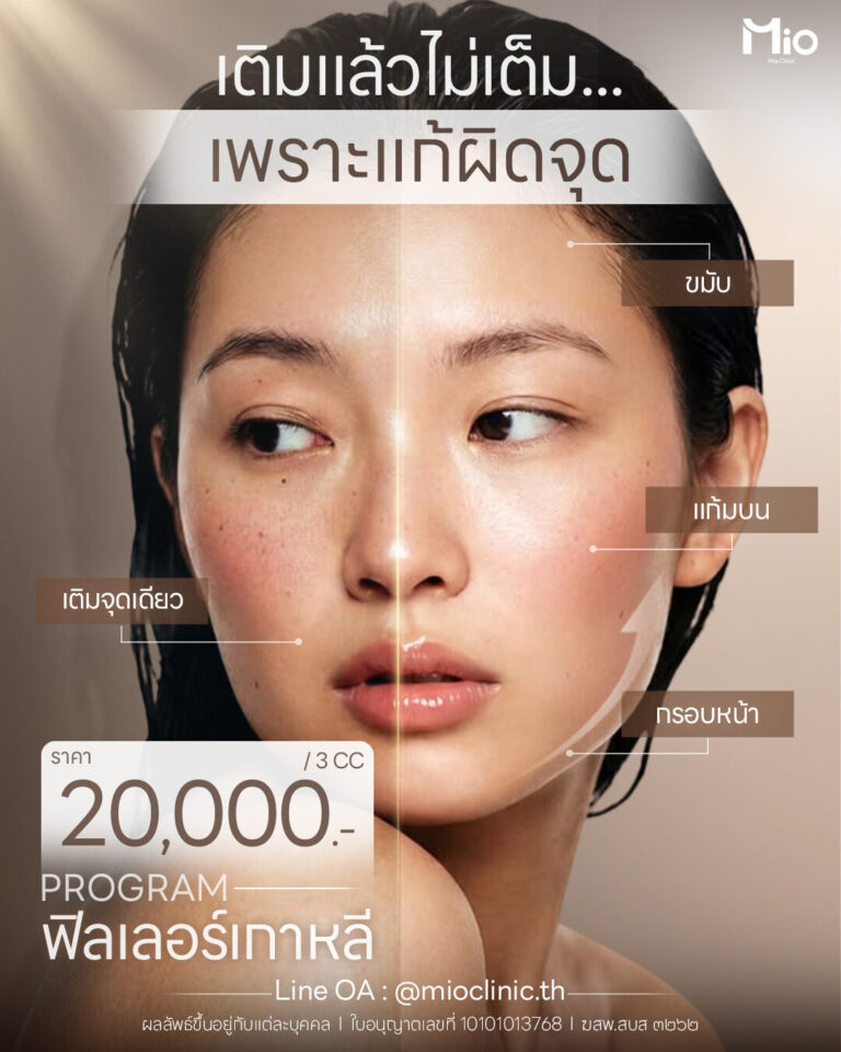 mio clinic filler 3cc face balance program 20000