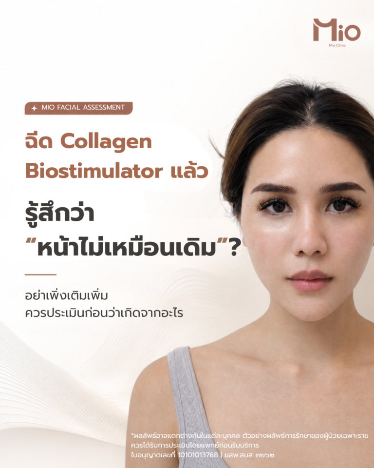 ollagen biostimulator facial assessment mio clinic