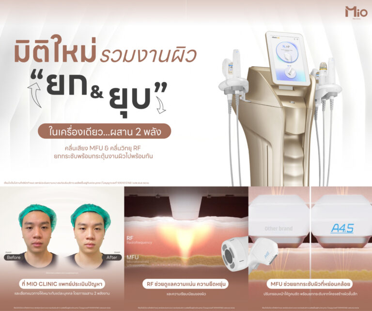 doublo new 2 mfu rf review mio clinic rama9 1