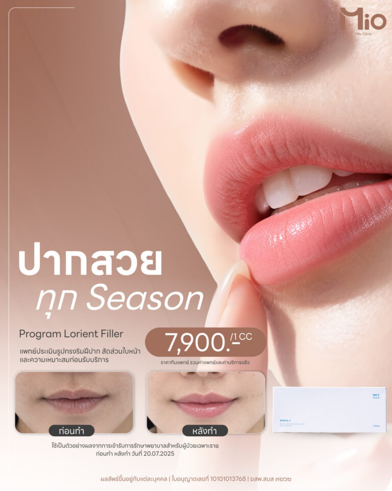 lorient filler lip design promotion mio clinic rama9