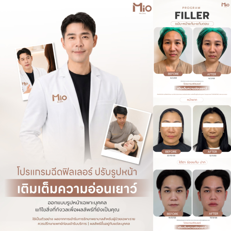 mio clinic filler review face contouring overall fb 1080x1080 1