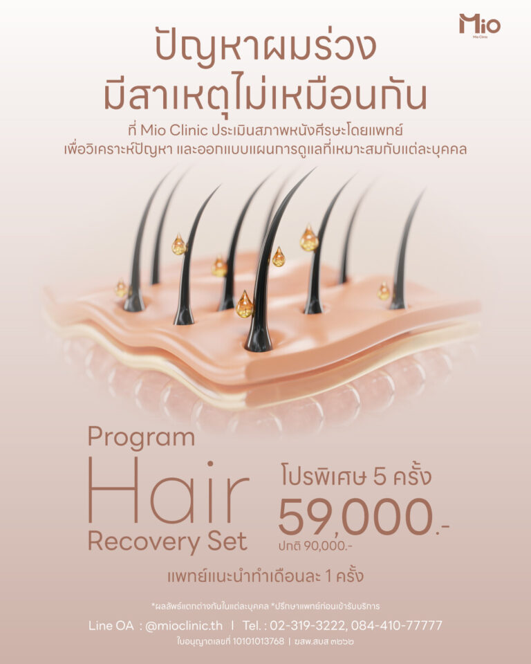 mio clinic hair recovery program hair loss 5 sessions