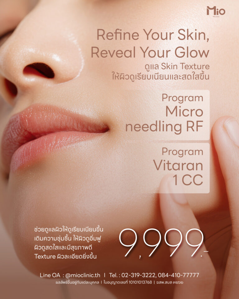 mio clinic skin texture microneedling rf vitaran 9999