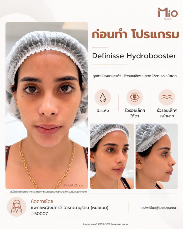 review definisse hydrobooster under eye forehead mid cheek mio clinic