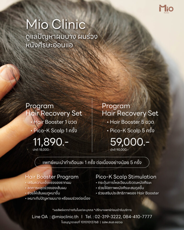 โปรแกรมดูแลผมบาง ผมร่วง hair recovery mio clinic พระราม9