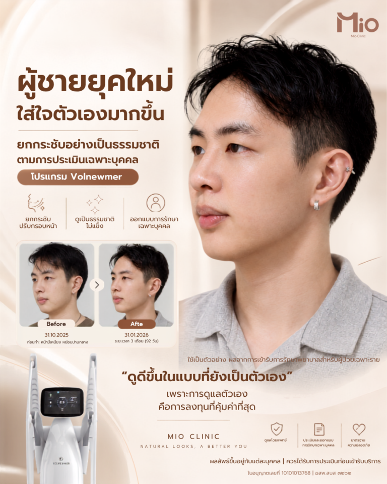 volnewmer review male face lifting mio clinic rama9 ig